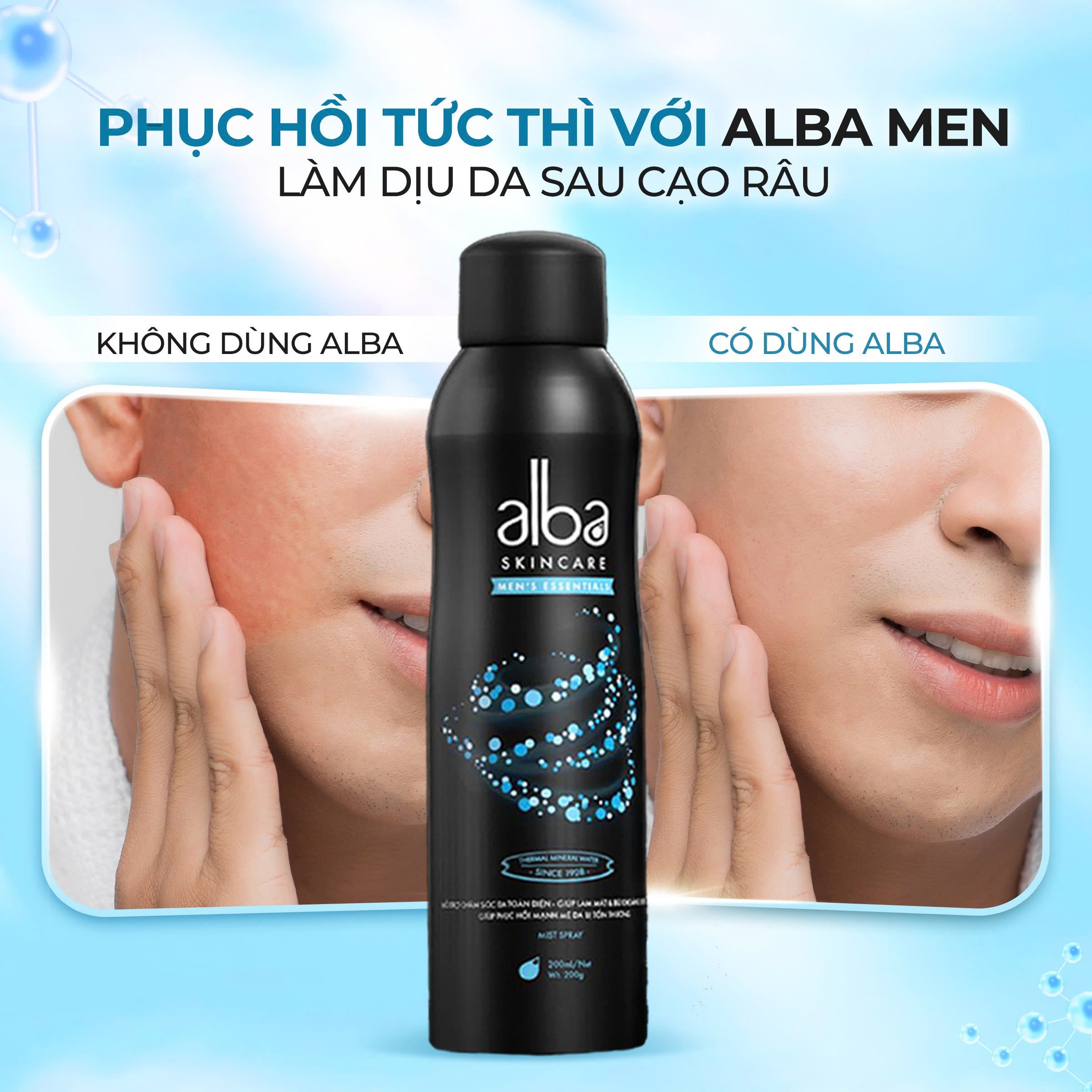 [MEN] XỊT KHOÁNG ALBA MEN CẤP ẨM - KIỀM DẦU CHO NAM