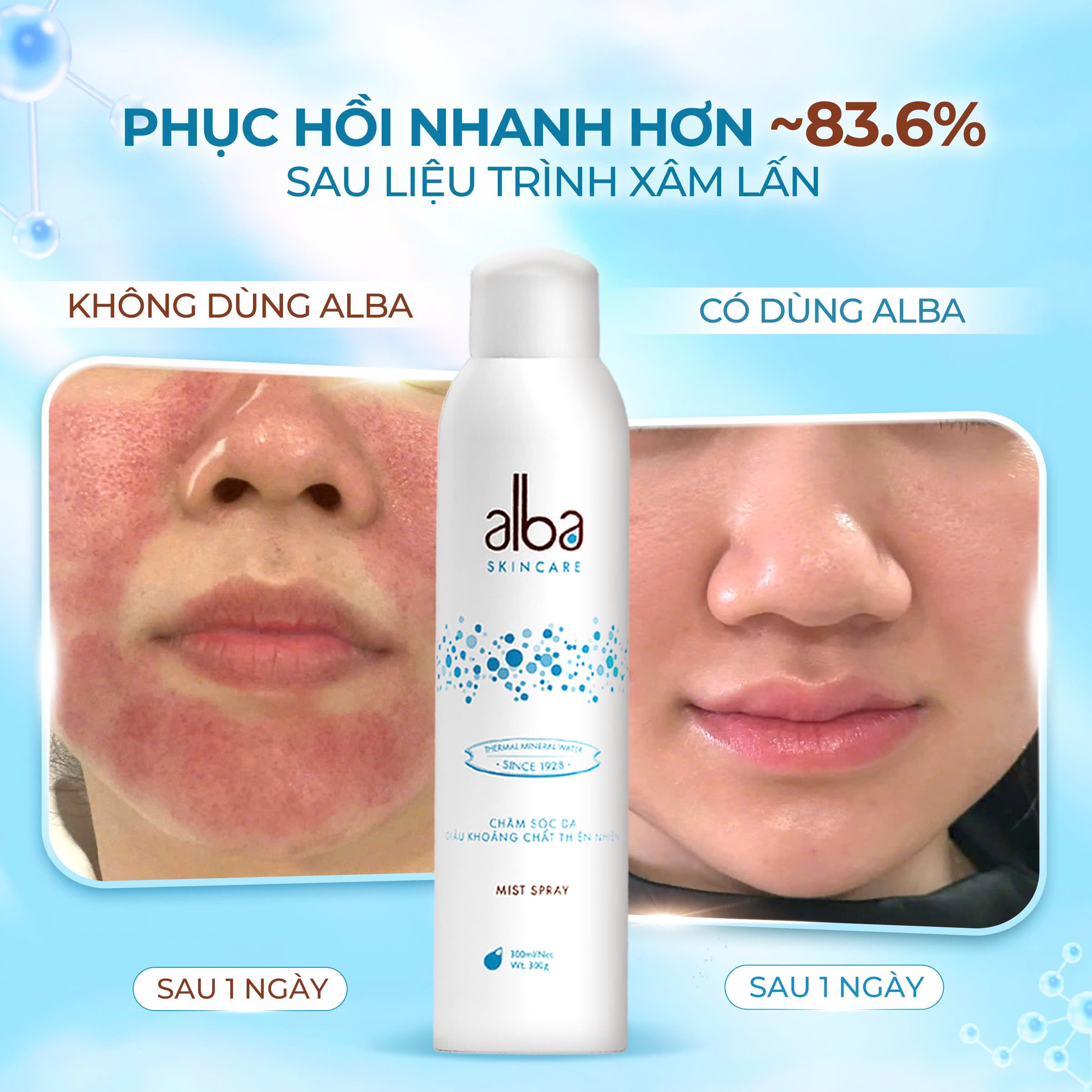 [LADY] XỊT KHOÁNG ALBA LADY CẤP ẨM VÀ PHỤC HỒI DA CHO NÀNG