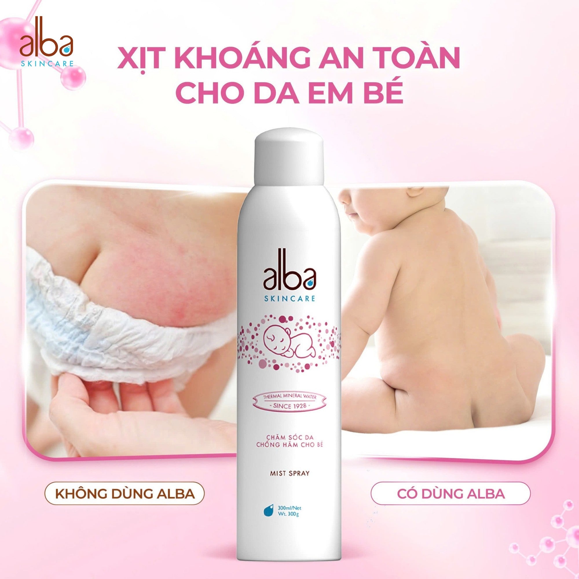 [BABY] XỊT KHOÁNG ALBA BABY DỊU NHẸ VÀ CHỐNG HĂM CHO BÉ